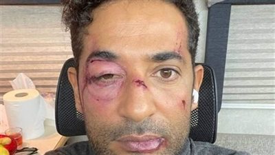 ظهور صاډم لـ عمرو سعد يهز مواقع التواصل.. ما القصة؟