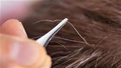 معلومة دينية: لماذا نهانها النبي عليه الصلاة والسلام عن نتف الشيب مفاجأة يكشفها العلم الحديث