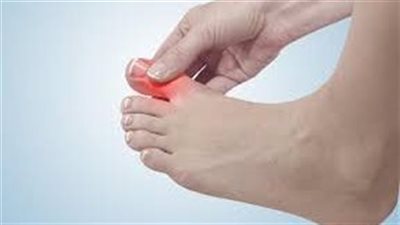 يه.دد حياتك.. 4 علامات في قدميك تدل على إصابتك بالتليف الكبدي