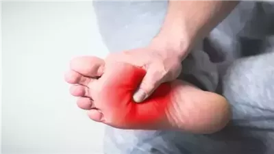 ١٢ سبب سخونة القدمين و ١٠ طرق للعلاج الطبيعي