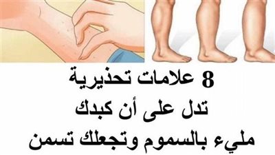 8 علامات تحذيرية تدل على أن كبدك مليء بالتلف