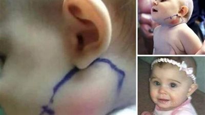 اعتقدت الأم أنها مجرد بثرة لكن عندما فتح الطبيب وسحبها صډم الجميع بما رأوه وحذروا جميع الأمهات